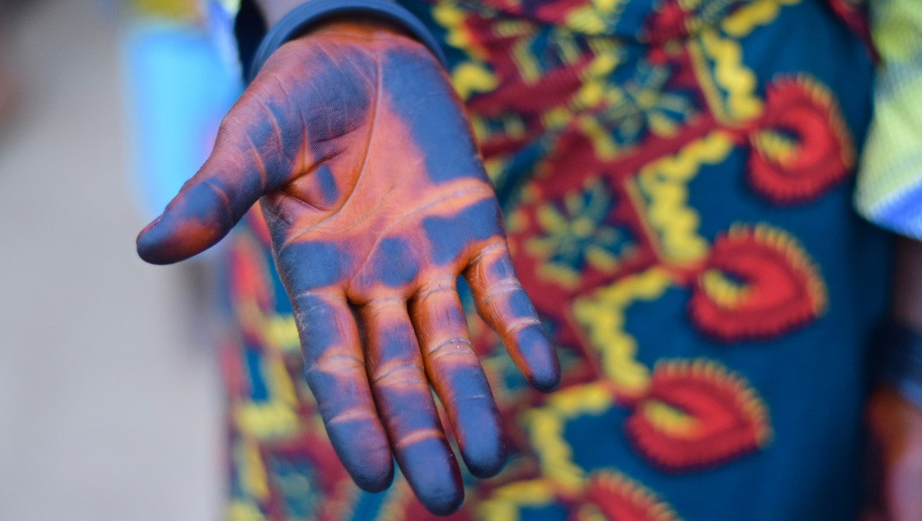 Soigner en Afrique : la tradition, ça a du bon